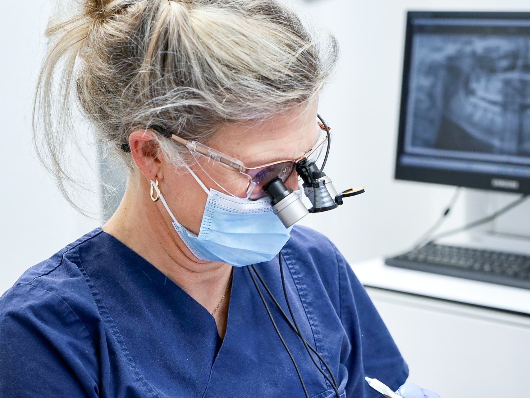 Wurzelkanalbehandlung (Endodontie)